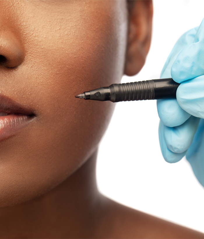 A close-up shot of a cosmetologist ready to mark on a patient's face.