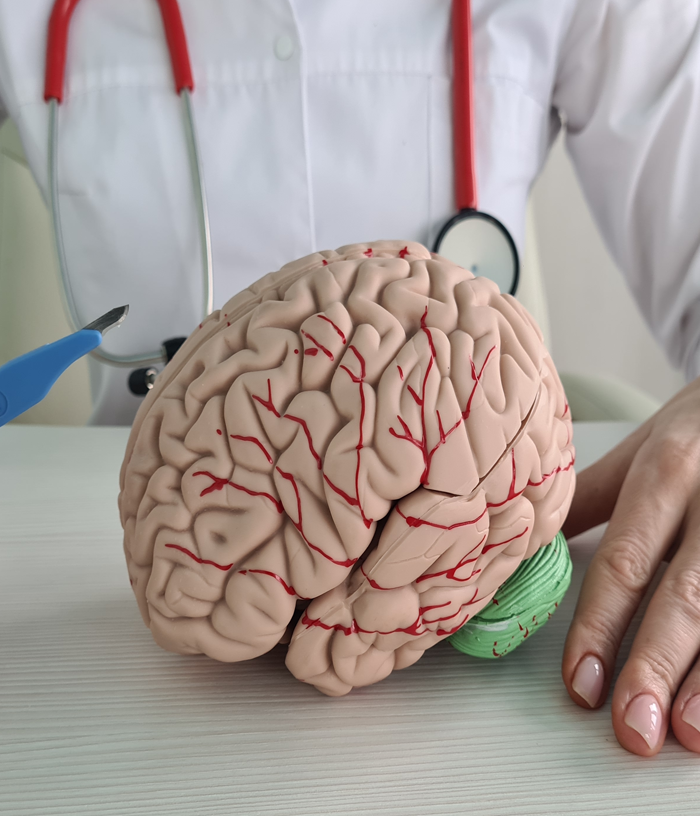 A medical expert with the model of a human brain illustrate neuro-sciences.