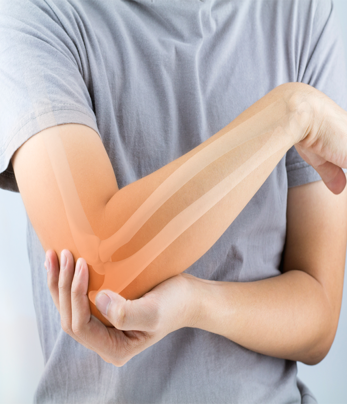 The close-up shot of a patient holding his elbow illustrates the need for orthopaedic care.