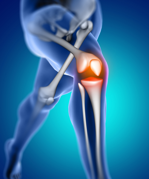 An anatomy image of a knee joint with pain.