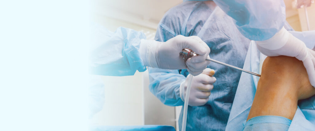 Unveiling the Difference Between Arthroscopic Surgery & Open Surgery 