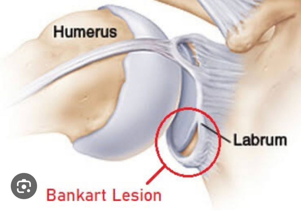 Image illustration of internal structure of knee.