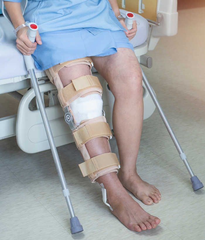 Image of a patient sitting on bed in hospital ware knee brace support after do posterior cruciate ligament surgery.