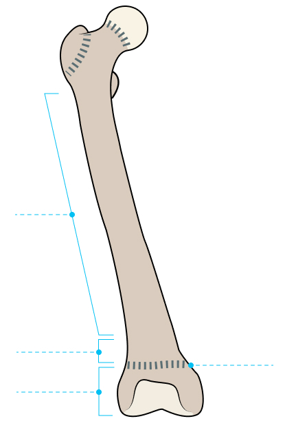 Image showing the anatomy of the Paediatric Bone.